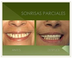 Slider image (6) Dr. Rojas Esthetique Dental Clinic